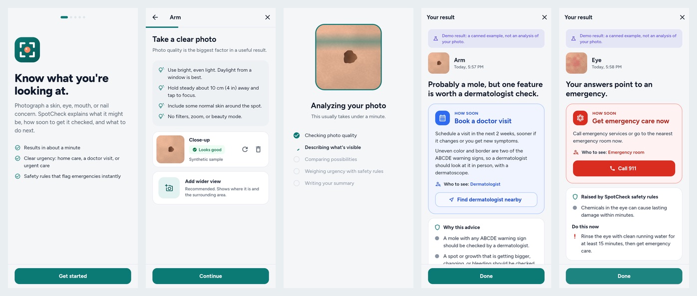 Five SpotCheck phone screens: welcome, photo tips, analysis progress, a result recommending a dermatologist visit, and an emergency result.